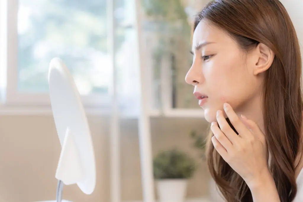 Woman looking in the mirror worried about skin issue on her face